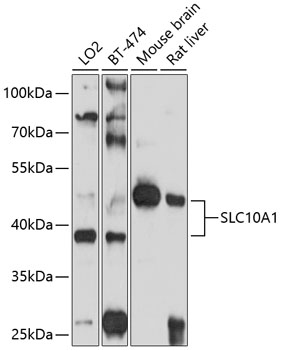 Western blot - SLC10A1 Polyclonal Antibody 