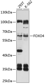 Western blot - FOXO4 Polyclonal Antibody 