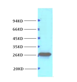 Western blot analysis of Hela, diluted at 1:1000