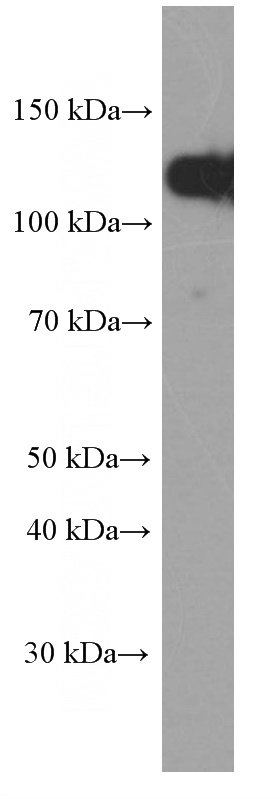 A431 cells were subjected to SDS PAGE followed by western blot with Catalog No:107244(E-cadherin Antibody) at dilution of 1:8000