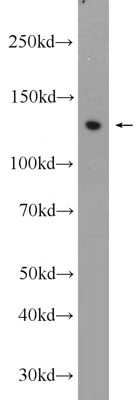 A375 cells were subjected to SDS PAGE followed by western blot with Catalog No:116908(ZBTB10 Antibody) at dilution of 1:300