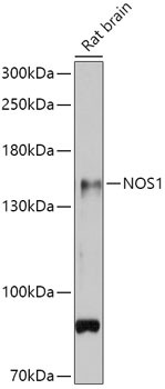 Western blot - NOS1 Polyclonal Antibody 