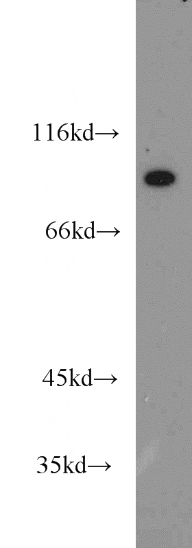 mouse colon tissue were subjected to SDS PAGE followed by western blot with Catalog No:108349(ATP4B antibody) at dilution of 1:800