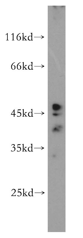 HeLa cells were subjected to SDS PAGE followed by western blot with Catalog No:110749(FUT7 antibody) at dilution of 1:500