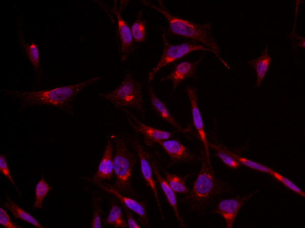 SLC2A4 Antibody, Rabbit PAb, Antigen Affinity Purified, Immunofluorescence