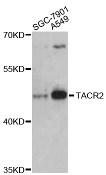 Western blot - TACR2 Polyclonal Antibody 