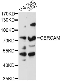 Western blot - CERCAM Polyclonal Antibody 