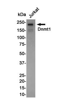 Western blot detection of Dnmt1 in Jurkat cell lysates using Dnmt1 Rabbit pAb(1:1000 diluted).Predicted band size:183KDa.Observed band size:183KDa.