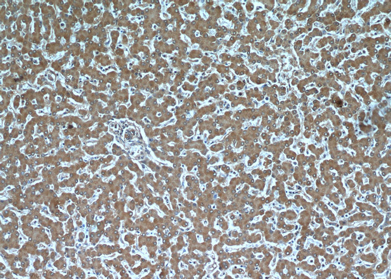 Immunohistochemical of paraffin-embedded human liver using Catalog No:107650(TTL antibody) at dilution of 1:50 (under 10x lens)