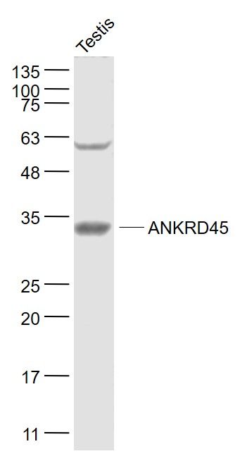 Fig1: Sample:; Testis(Rat) Lysate at 40 ug; Primary: Anti- ANKRD45 at 1/1000 dilution; Secondary: IRDye800CW Goat Anti-Rabbit IgG at 1/20000 dilution; Predicted band size: 32 kD; Observed band size: 32 kD
