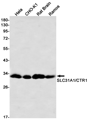 Western blot detection of SLC31A1/CTR1 in Hela,CHO-K1,Rat Brain,Ramos cell lysates using SLC31A1/CTR1 Rabbit mAb(1:1000 diluted).Predicted band size:21kDa.Observed band size:21kDa.