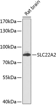 Western blot - SLC22A2 Polyclonal Antibody 