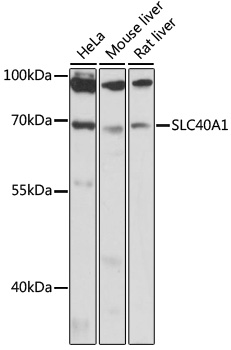 Western blot - SLC40A1 Polyclonal Antibody 
