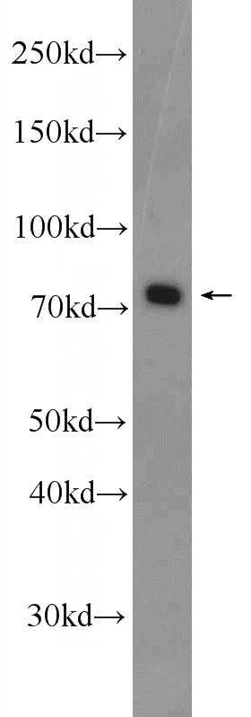 Jurkat cells were subjected to SDS PAGE followed by western blot with Catalog No:111283(HCLS1 Antibody) at dilution of 1:1000