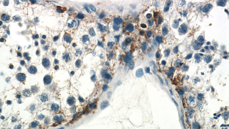 Immunohistochemistry of paraffin-embedded human testis tissue slide using Catalog No:114474(RASA1 Antibody) at dilution of 1:50 (under 40x lens)