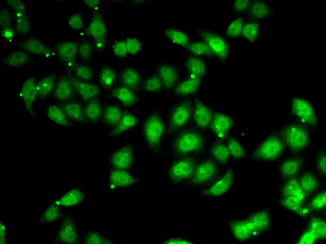 Immunofluorescence - AFF1 Polyclonal Antibody 