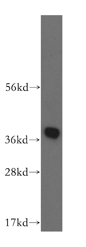 human liver tissue were subjected to SDS PAGE followed by western blot with Catalog No:111550(HSD17B7P2 antibody) at dilution of 1:500