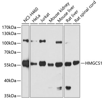 Western blot - HMGCS1 Polyclonal Antibody 