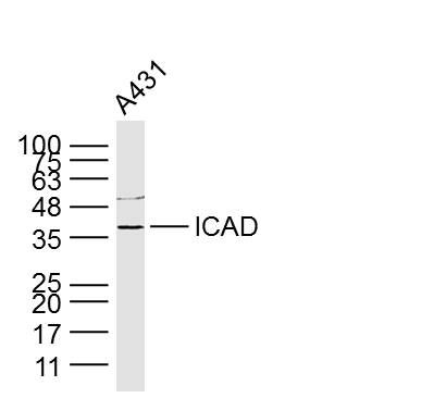 Fig2: Sample: A431 Cell (Human) Lysate at 40 ug; Primary: Anti-ICAD at 1/300 dilution; Secondary: IRDye800CW Goat Anti-Rabbit IgG at 1/20000 dilution; Predicted band size: 36 kD; Observed band size: 36 kD