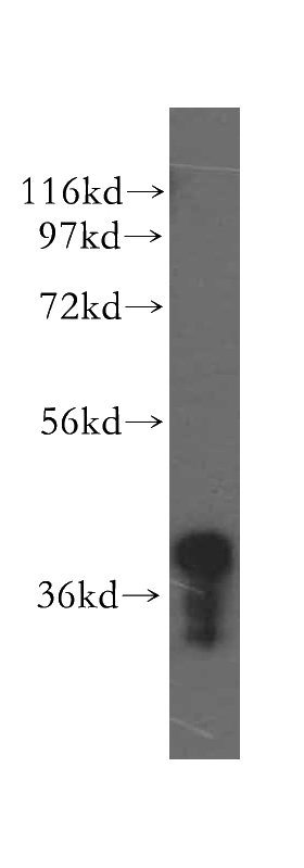 HeLa cells were subjected to SDS PAGE followed by western blot with Catalog No:112828(MRPL44 antibody) at dilution of 1:500