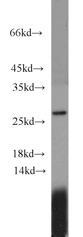 MCF7 cells were subjected to SDS PAGE followed by western blot with Catalog No:110977(GINS3 antibody) at dilution of 1:1000