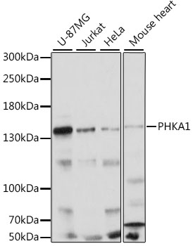 Western blot - PHKA1 Polyclonal Antibody 