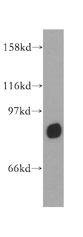 mouse testis tissue were subjected to SDS PAGE followed by western blot with Catalog No:116430(TSGA10 antibody) at dilution of 1:300