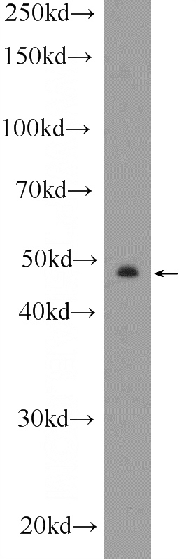SKOV-3 cells were subjected to SDS PAGE followed by western blot with Catalog No:109680(CYP11B2 Antibody) at dilution of 1:300