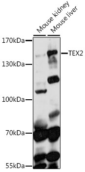 Western blot - TEX2 Polyclonal Antibody 