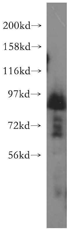 HeLa cells were subjected to SDS PAGE followed by western blot with Catalog No:115788(GOLSYN antibody) at dilution of 1:500