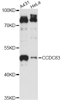 Western blot - CCDC83 Polyclonal Antibody 