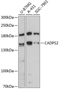 Western blot - CADPS2 Polyclonal Antibody 