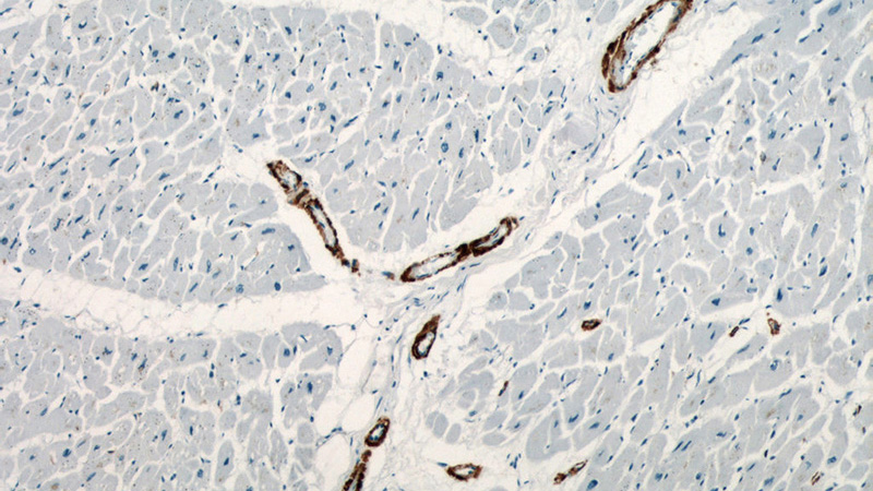 Immunohistochemical of paraffin-embedded human heart using Catalog No:107706(ACTA2 antibody) at dilution of 1:500 (under 10x lens)