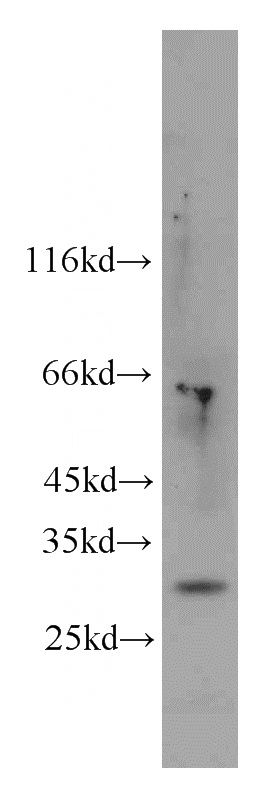 RAW264.7 cells were subjected to SDS PAGE followed by western blot with Catalog No:109271(CHOP; GADD153 antibody) at dilution of 1:1000