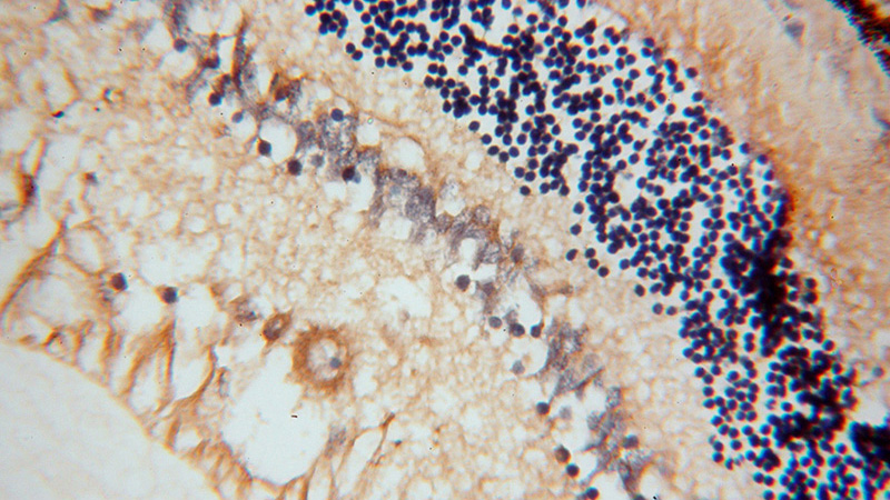 Immunohistochemical of paraffin-embedded human eye using Catalog No:107919(AIPL1 antibody) at dilution of 1:50 (under 40x lens)