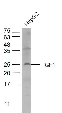 Fig3: Sample: HepG2 (human) Lysate at 40 ug; Primary: Anti-IGF1 at 1/500 dilution Secondary: IRDye800CW Goat Anti-Rabbit IgG at 1/20000 dilution Predicted band size: 7.7/21 kD Observed band size: 25 kD