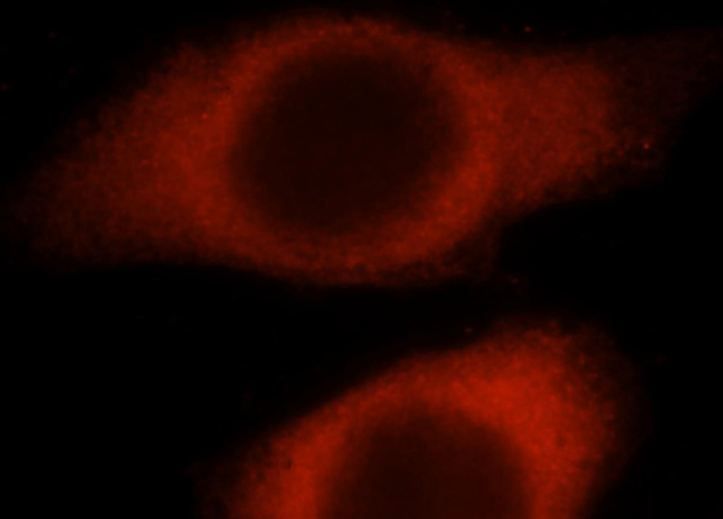 Immunofluorescent analysis of MCF-7 cells, using HARS antibody Catalog No:111256 at 1:25 dilution and Rhodamine-labeled goat anti-rabbit IgG (red).