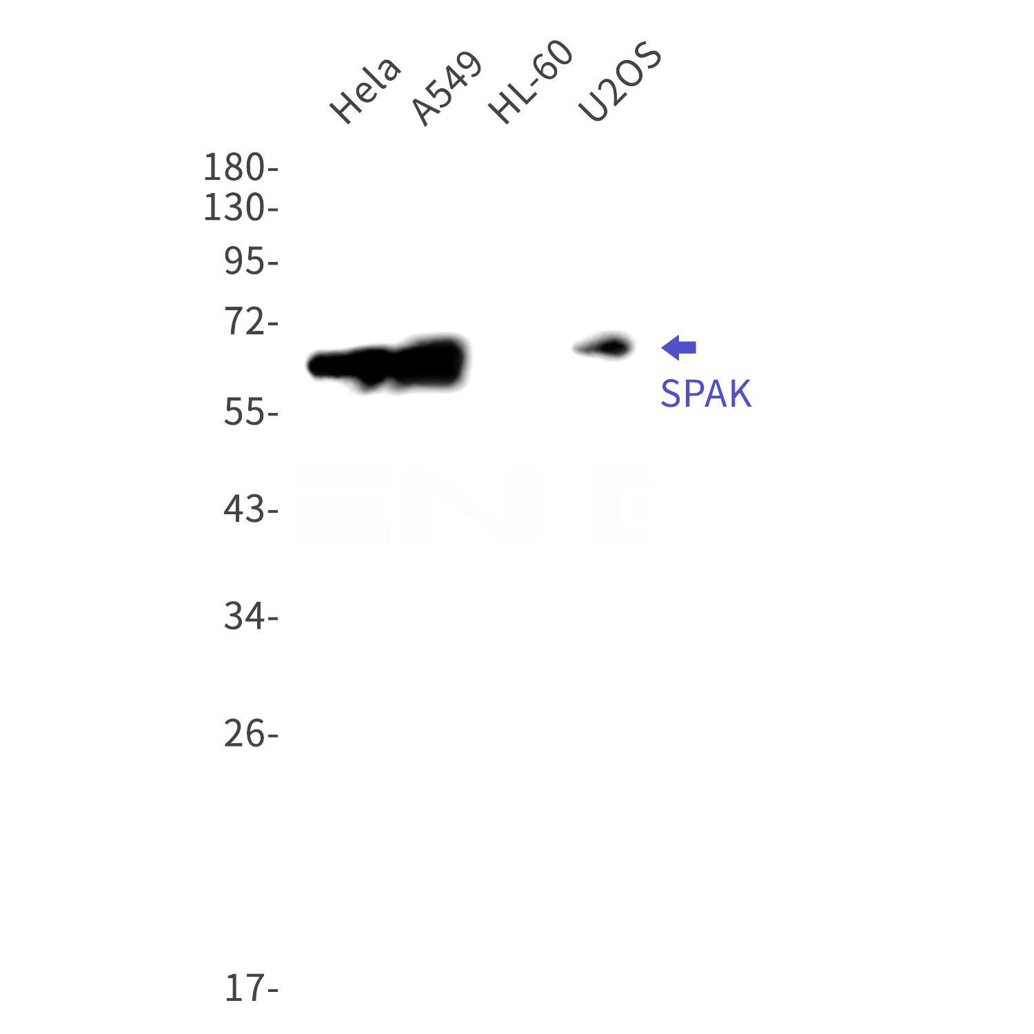 Western blot detection of SPAK in Hela,A549,HL-60,U2OS cell lysates using SPAK Rabbit mAb(1:1000 diluted).Predicted band size:60kDa.Observed band size:65kDa.