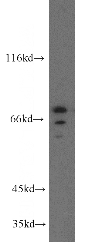 PC-3 cells were subjected to SDS PAGE followed by western blot with Catalog No:115028(SDCCAG8 antibody) at dilution of 1:500