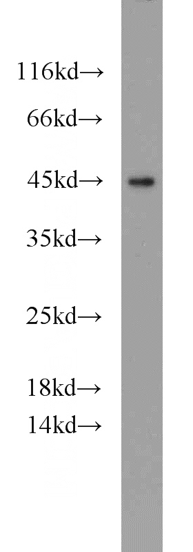 HeLa cells were subjected to SDS PAGE followed by western blot with Catalog No:108721(C3orf21 antibody) at dilution of 1:800