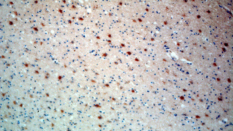Immunohistochemical of paraffin-embedded human brain using Catalog No:115808(STXBP1 antibody) at dilution of 1:100 (under 10x lens)