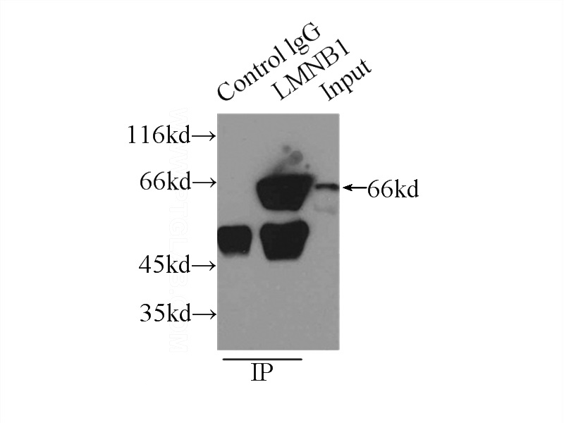 IP Result of anti-LMNB1 (IP:Catalog No:117329, 3ug; Detection:Catalog No:117329 1:1000) with HeLa cells lysate 2500ug.