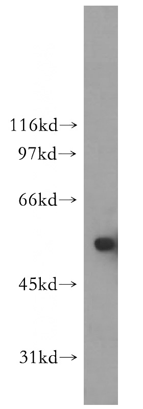 PC-3 cells were subjected to SDS PAGE followed by western blot with Catalog No:116940(ZMPSTE24 antibody) at dilution of 1:400