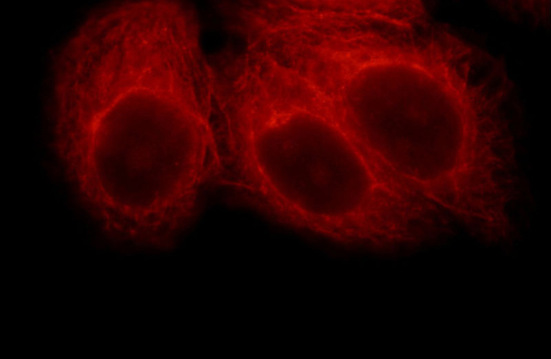 Immunofluorescent analysis of HepG2 cells, using MYCBPAP antibody Catalog No:112916 at 1:25 dilution and Rhodamine-labeled goat anti-rabbit IgG (red).