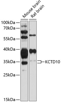 Western blot - KCTD10 Polyclonal Antibody 