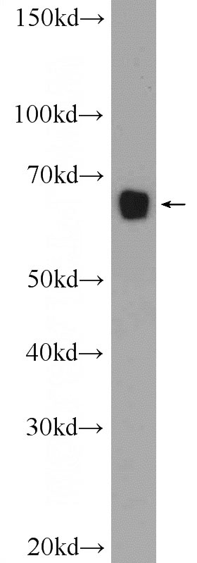 HeLa cells were subjected to SDS PAGE followed by western blot with Catalog No:112094(KLHL15 Antibody) at dilution of 1:600