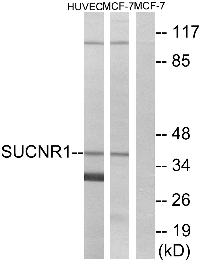 Fig1:; Western blot analysis of lysates from HUVEC and MCF-7 cells, using SUCNR1 Antibody. The lane on the right is blocked with the synthesized peptide.