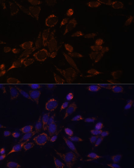 Immunofluorescence - ACAT1 Polyclonal Antibody 