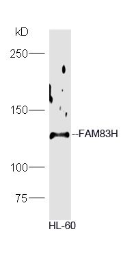 Fig2: Protein: HL-60(human) lysate at 40ug;; Primary: rabbit Anti-FAM83H at 1:300;; Secondary: HRP conjugated Goat-Anti-rabbit IgG(bs-0295G-HRP) at 1: 5000;; Predicted band size: 127 kD; Observed band size: 127 kD