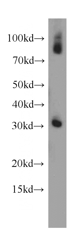 human skeletal muscle tissue were subjected to SDS PAGE followed by western blot with Catalog No:113961(PLEKHF1 antibody) at dilution of 1:500